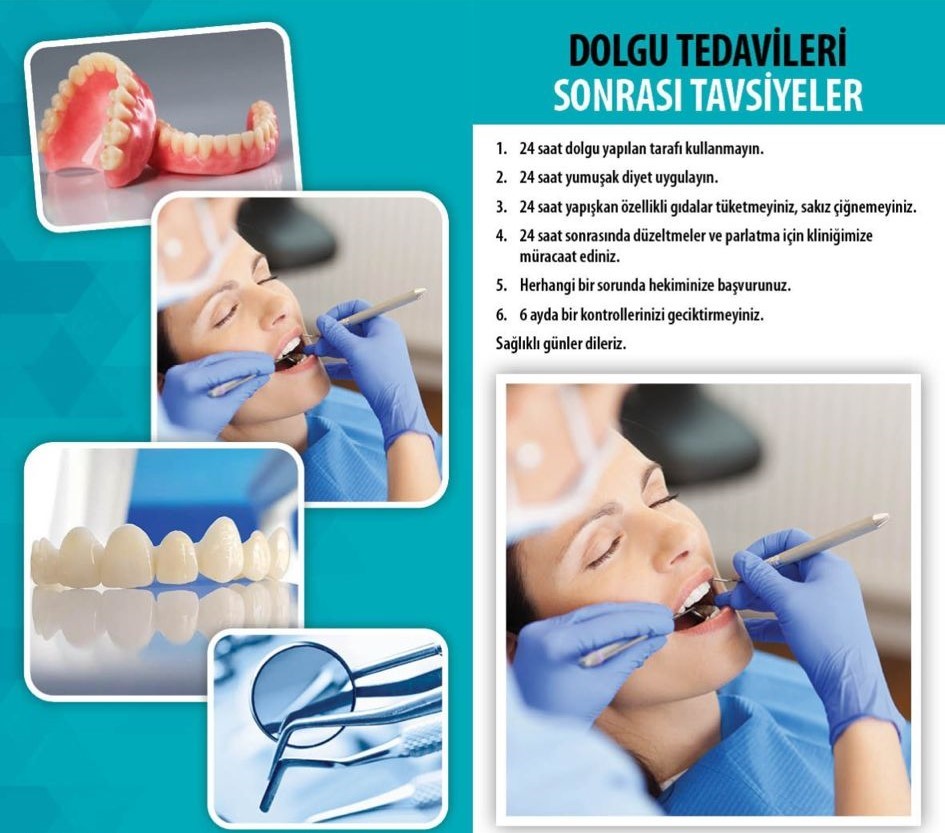 Dolgu Tedavisi Sonrası Tavsiyeler