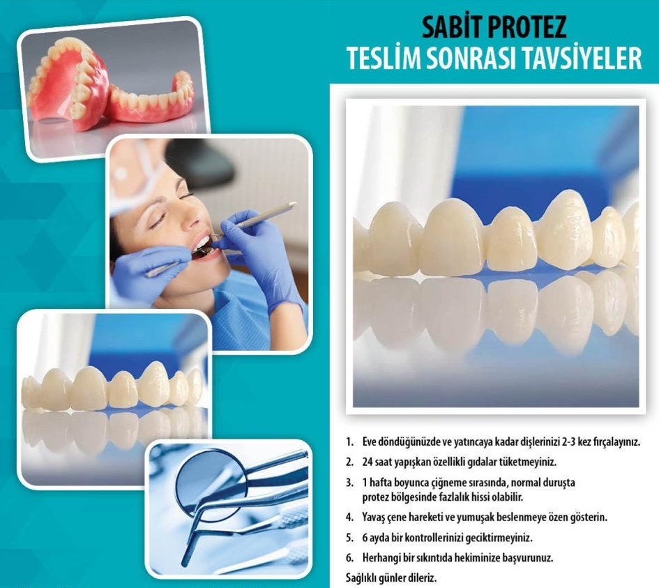 Sabit Protez Sonrası Tavsiyeler